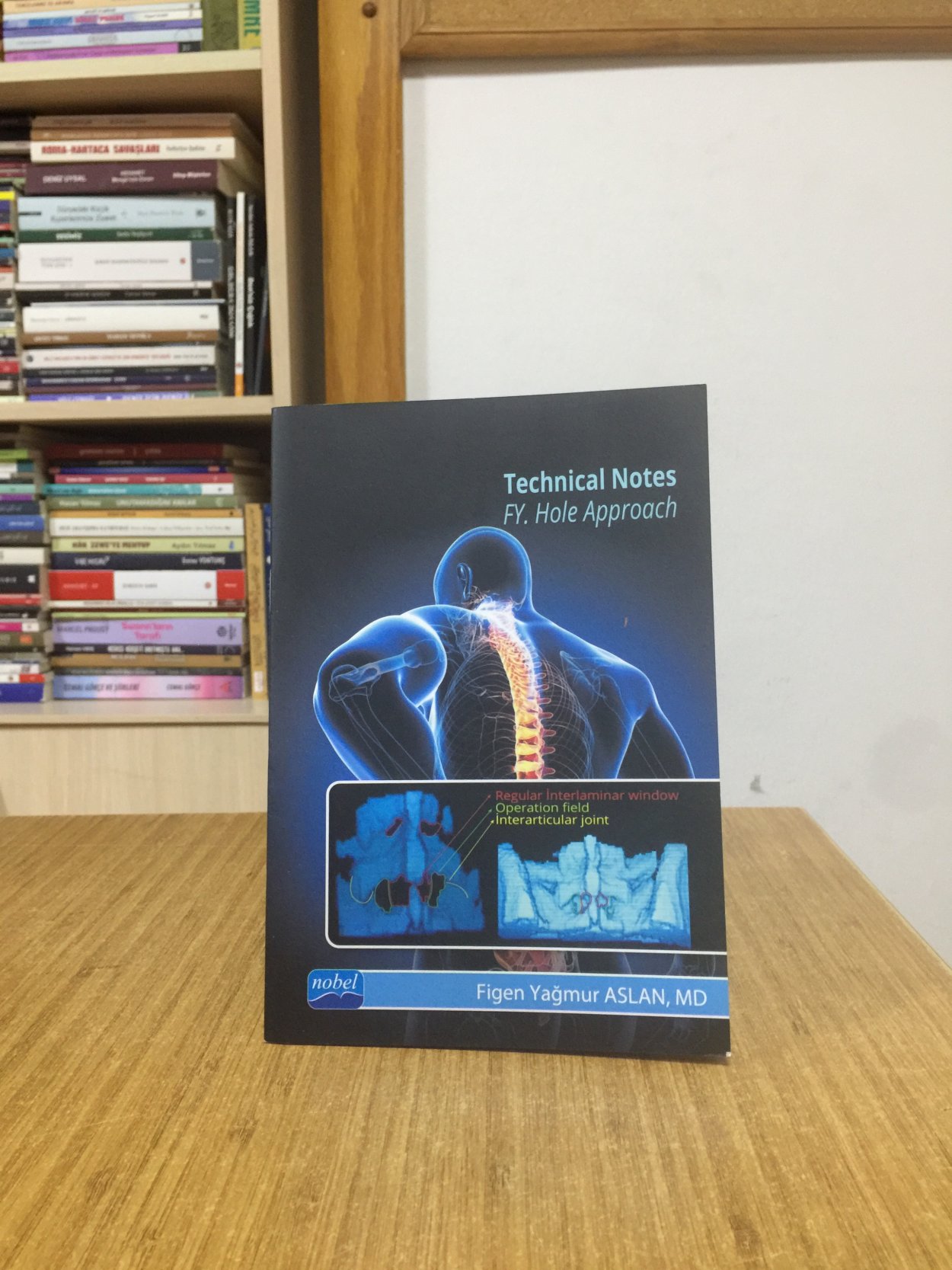 Technical Notes FY. Hole Approach - Figen Yağmur Aslan